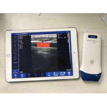 handheld wireless ultrasound for phone and pad